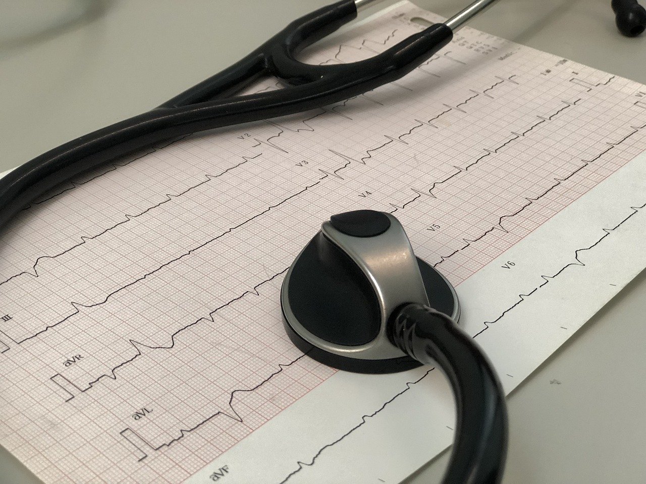 Kiedy wykonać EKG wysiłkowe – co może ono wykazać?